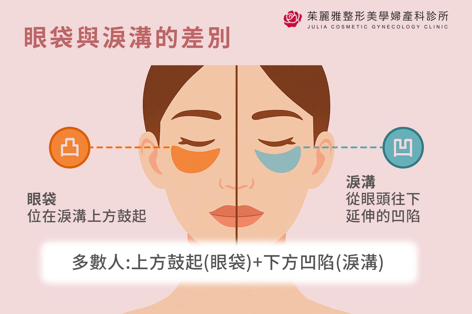 眼袋與淚溝