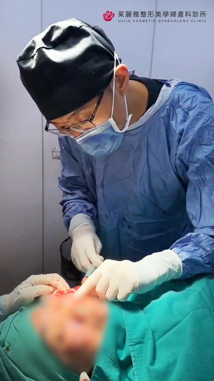 整形外科潘致皓醫師 眼袋手術 威萃