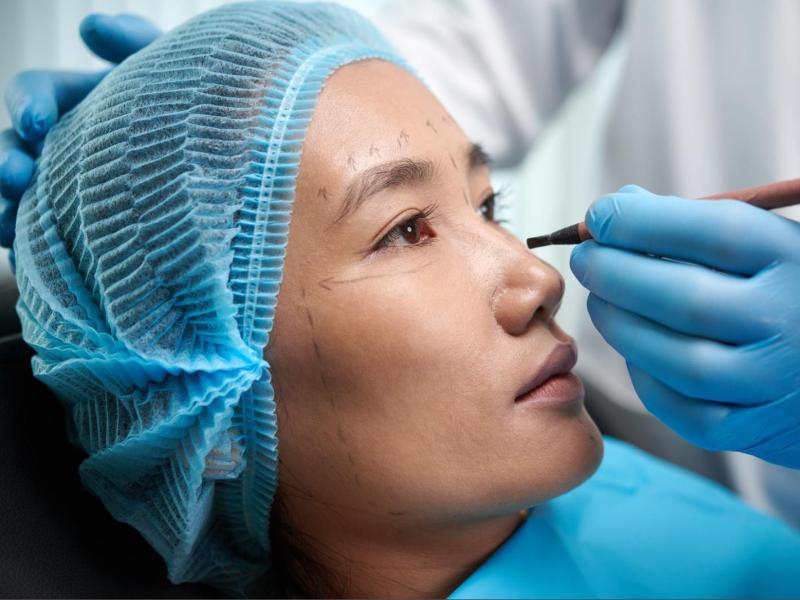 眼袋手術全解析｜3種手術方式、費用、優缺點、適用對象介紹